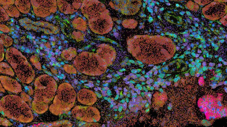 Images of fluorescent cells in orange, blue, purple, pink, and green are shown on a black background. 